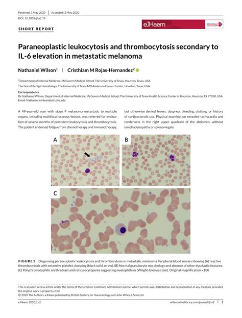 thrombocytosis and mpv